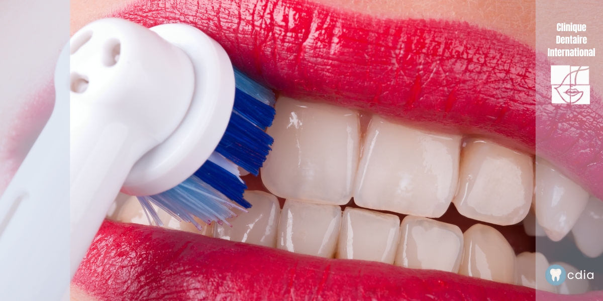 bicarbonate de soude pour les dents