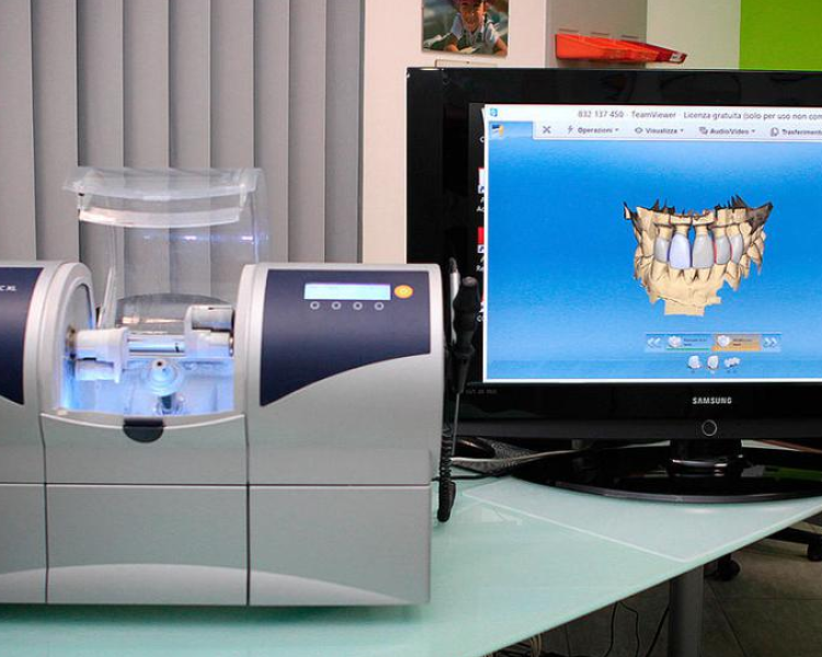 La CFAO dentaire (CAD-CAM)